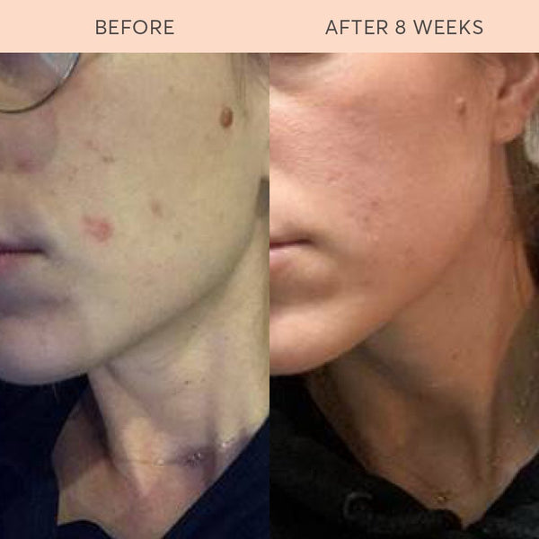Complete Skin Food Elixir™ Ultimate 1.0