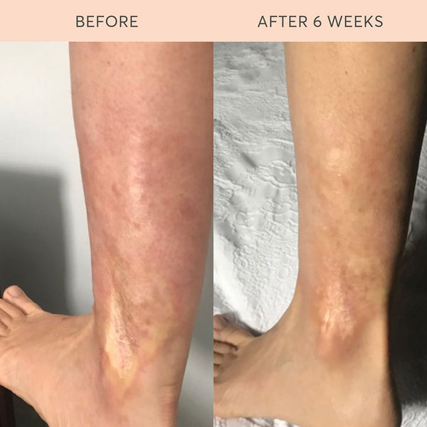 Complete Skin Food Elixir™ Ultimate 1.0