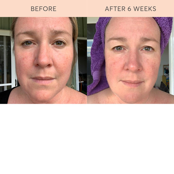 Complete Skin Food Elixir™ Ultimate 1.0