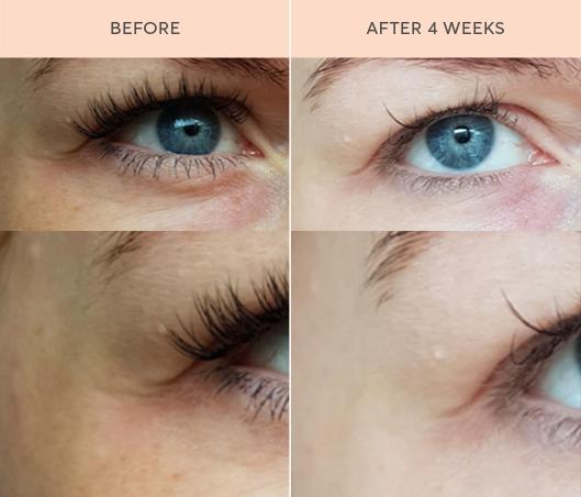 Complete Skin Food Elixir™ Ultimate 1.0